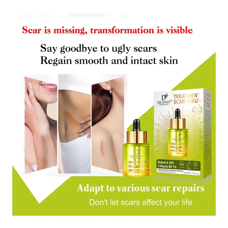 DR.DAVEY Cold Pressed Treatment Scar Serum with Retinol Body Oil 50ml white background product image for OEM/ODM private label essential oil manufacturing